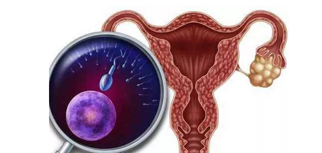 子宫肌瘤的神秘起源：揭开女性生殖健康的秘密