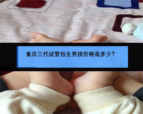 重庆三代试管包生男孩价格是多少？
